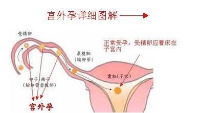 通草的功效与作用能通输卵管堵塞,实地分析验证数据_标配版79.255