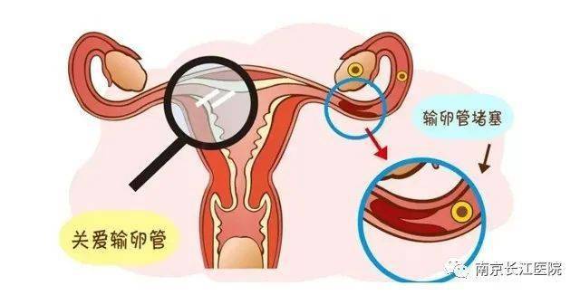 通草的功效与作用能通输卵管堵塞,理论依据解释定义_4DM36.726